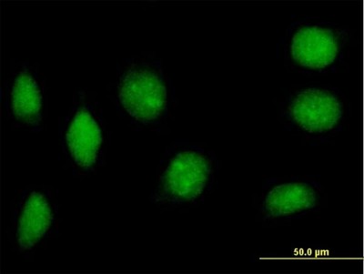 Immunocytochemistry/Immunofluorescence: NAP1L2 Antibody [H00004674-B01P] - Analysis of purified antibody to NAP1L2 on HeLa cell. (antibody concentration 10 ug/ml)