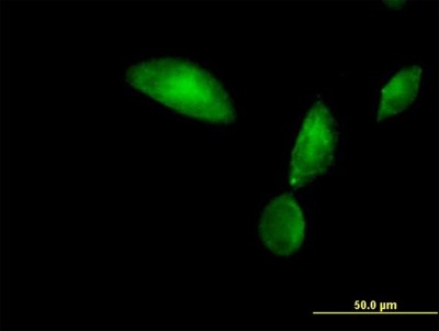 Immunocytochemistry/Immunofluorescence: Tropomodulin 3 Antibody [H00029766-B01P] - Analysis of purified antibody to TMOD3 on HeLa cell. (antibody concentration 10 ug/ml)