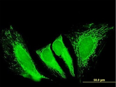 Immunocytochemistry/Immunofluorescence: RTKN2 Antibody [H00219790-B01P] - Analysis of purified antibody to RTKN2 on HeLa cell. (antibody concentration 10 ug/ml)