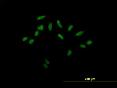 Immunocytochemistry/Immunofluorescence: DKFZp761H1710 Antibody [H00083459-B01P] - Analysis of purified antibody to DKFZP761H1710 on HeLa cell. (antibody concentration 10 ug/ml)