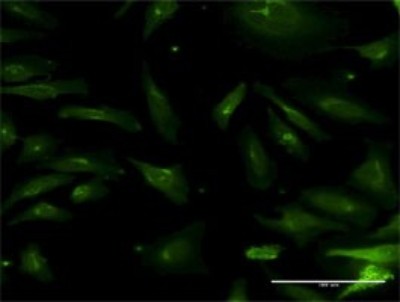 Immunocytochemistry/Immunofluorescence: NMNAT-2 Antibody (2G8) [H00023057-M04] - Analysis of monoclonal antibody to NMNAT2 on HeLa cell. Antibody concentration 10 ug/ml