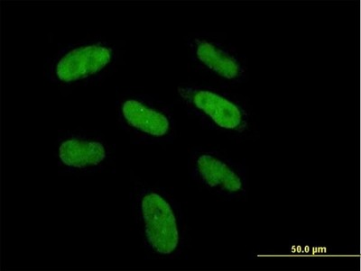 Immunocytochemistry/Immunofluorescence: DGCR6 Antibody [H00008214-B01P] - Analysis of purified antibody to DGCR6 on HepG2 cell. (antibody concentration 20 ug/ml)