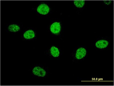 Immunocytochemistry/Immunofluorescence: MIPOL1 Antibody (1B7) [H00145282-M04] - Analysis of monoclonal antibody to MIPOL1 on HeLa cell. Antibody concentration 10 ug/ml
