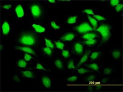 Immunocytochemistry/Immunofluorescence: SLC2A4RG Antibody (4C10) [H00056731-M02] - Analysis of monoclonal antibody to SLC2A4RG on HeLa cell. Antibody concentration 10 ug/ml.