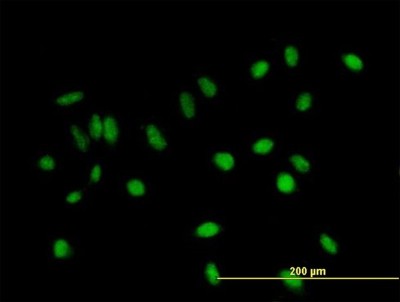 Immunocytochemistry/Immunofluorescence: BCA3 Antibody [H00056672-B01P] - Analysis of purified antibody to C11orf17 on HeLa cell. (antibody concentration 10 ug/ml)
