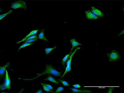 Immunocytochemistry/Immunofluorescence: GNPAT Antibody [H00008443-D01P] - Analysis of antibody to GNPAT on HeLa cell. Antibody concentration 30 ug/ml.