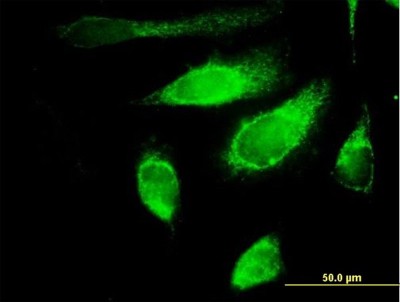 Immunocytochemistry/Immunofluorescence: POLG2 Antibody [H00011232-B01P] - Analysis of purified antibody to POLG2 on HeLa cell. (antibody concentration 10 ug/ml)
