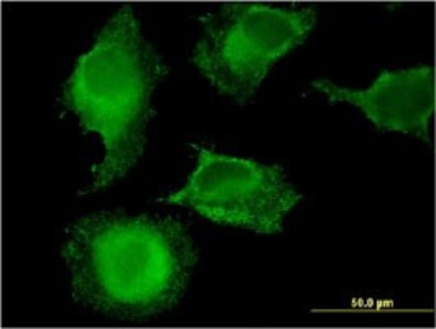 Immunocytochemistry/Immunofluorescence: MARCH9 Antibody (2B5) [H00092979-M01] - Analysis of monoclonal antibody to MARCH9 on HeLa cell. Antibody concentration 10 ug/ml.