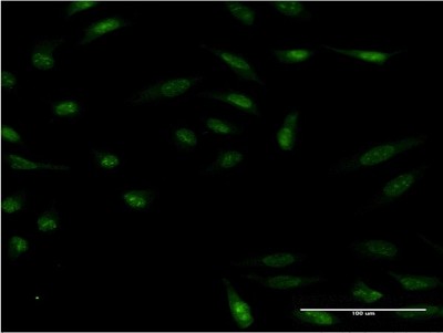 Immunocytochemistry/Immunofluorescence: HMX2 Antibody (1D7) [H00003167-M08] - Analysis of monoclonal antibody to HMX2 on HeLa cell. Antibody concentration 10 ug/ml