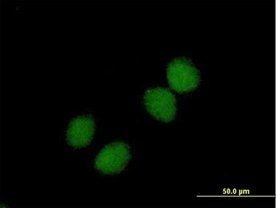 Immunocytochemistry/Immunofluorescence: Choline Kinase beta Antibody [H00001120-B01P] - Analysis of purified antibody to CHKB on HeLa cell. (antibody concentration 10 ug/ml)