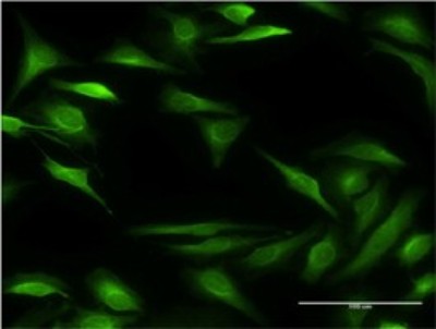 Immunocytochemistry/Immunofluorescence: 15-Lipoxygenase 2 Antibody (4A7) [H00000247-M05] - Analysis of monoclonal antibody to ALOX15B on HeLa cell. Antibody concentration 10 ug/ml