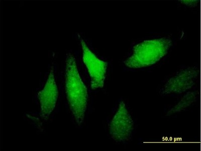 Immunocytochemistry/Immunofluorescence: DNALI1 Antibody [H00007802-B01P] - Analysis of purified antibody to DNALI1 on HeLa cell. (antibody concentration 10 ug/ml)