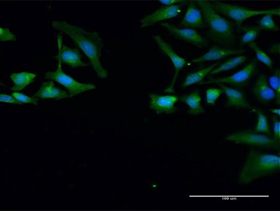 Immunocytochemistry/Immunofluorescence: SNRPB Antibody [H00006628-D01P] - Analysis of antibody to SNRPB on HeLa cell. Antibody concentration 30 ug/ml.