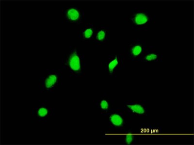 Immunocytochemistry/Immunofluorescence: TBX6 Antibody (1D11) [H00006911-M06] - Analysis of monoclonal antibody to TBX6 on HeLa cell. Antibody concentration 35 ug/ml