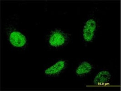 Immunocytochemistry/Immunofluorescence: PIPPIN Antibody (2H8) [H00027254-M01] - Analysis of monoclonal antibody to CSDC2 on HeLa cell. Antibody concentration 10 ug/ml.