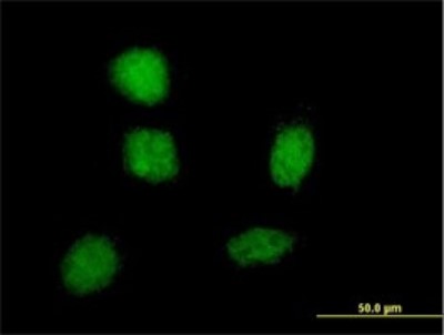 Immunocytochemistry/Immunofluorescence: SOX21 Antibody (2G10) [H00011166-M01] - Analysis of monoclonal antibody to SOX21 on HeLa cell. Antibody concentration 10 ug/ml.