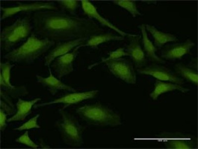 Immunocytochemistry/Immunofluorescence: ADP-Sugar Pyrophosphatase/NUDT5 Antibody [H00011164-D01P] - Analysis of antibody to NUDT5 on HeLa cell. Antibody concentration 10 ug/ml.