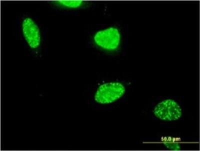 Immunocytochemistry/Immunofluorescence: PTIP Antibody (4C11) [H00022976-M02] - Analysis of monoclonal antibody to PAXIP1 on HeLa cell. Antibody concentration 10 ug/ml.