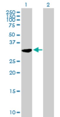 Western Blot: C21orf59 Antibody [H00056683-B01P] - Analysis of C21orf59 expression in transfected 293T cell line by C21orf59 polyclonal antibody.  Lane 1: C21orf59 transfected lysate(31.9 KDa). Lane 2: Non-transfected lysate.