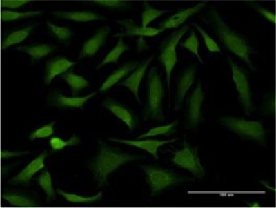 Immunocytochemistry/Immunofluorescence: SSH1 Antibody (1D2) [H00054434-M02] - Analysis of monoclonal antibody to SSH1 on HeLa cell. Antibody concentration 10 ug/ml.