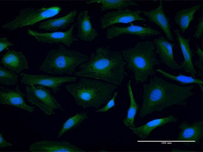 Immunocytochemistry/Immunofluorescence: Proteasome 20S beta 3 Antibody [H00005691-B02P] - Analysis of purified antibody to PSMB3 on HeLa cell. (antibody concentration 10 ug/ml)