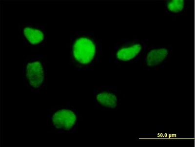 Immunocytochemistry/Immunofluorescence: ZFP161 Antibody [H00007541-B01P] - Analysis of purified antibody to ZFP161 on HeLa cell. (antibody concentration 10 ug/ml)