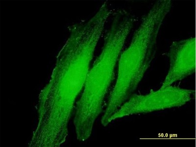 Immunocytochemistry/Immunofluorescence: Exosome component 1 Antibody [H00051013-B02P] - Analysis of purified antibody to EXOSC1 on HeLa cell. (antibody concentration 10 ug/ml)