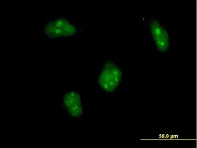 Immunocytochemistry/Immunofluorescence: Dlx1 Antibody [H00001745-B01P] - Analysis of purified antibody to DLX1 on HeLa cell. (antibody concentration 10 ug/ml)