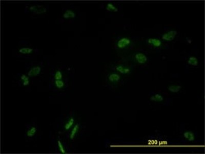 Immunocytochemistry/Immunofluorescence: CCNL1 Antibody (1F7-1C5) [H00057018-M01] - Analysis of monoclonal antibody to CCNL1 on HeLa cell. Antibody concentration 10 ug/ml.