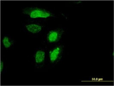 Immunocytochemistry/Immunofluorescence: RDH12 Antibody (1E11) [H00145226-M01] - Analysis of monoclonal antibody to RDH12 on HeLa cell. Antibody concentration 10 ug/ml.