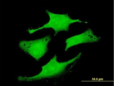 Immunocytochemistry/Immunofluorescence: RAB6IP1 Antibody [H00023258-B01P] - Analysis of purified antibody to RAB6IP1 on HeLa cell. (antibody concentration 10 ug/ml)