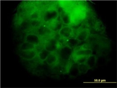 Immunocytochemistry/Immunofluorescence: MVD Antibody (2A7) [H00004597-M01] - Analysis of monoclonal antibody to MVD on A-431 cell. Antibody concentration 10 ug/ml.