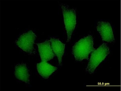 Immunocytochemistry/Immunofluorescence: REM1 Antibody [H00028954-B01P] - Analysis of purified antibody to REM1 on HeLa cell. (antibody concentration 10 ug/ml)