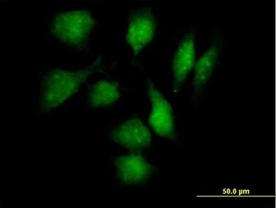 Immunocytochemistry/Immunofluorescence: TXNDC3 Antibody [H00051314-B01P] - Analysis of purified antibody to TXNDC3 on HeLa cell. (antibody concentration 10 ug/ml)