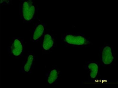 Immunocytochemistry/Immunofluorescence: ZNF193 Antibody [H00007746-B01P] - Analysis of purified antibody to ZNF193 on HepG2 cell. (antibody concentration 10 ug/ml)