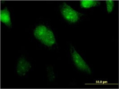 Immunocytochemistry/Immunofluorescence: MGC20410 Antibody (1B11) [H00116071-M01] - Analysis of monoclonal antibody to BATF2 on HeLa cell. Antibody concentration 10 ug/ml.