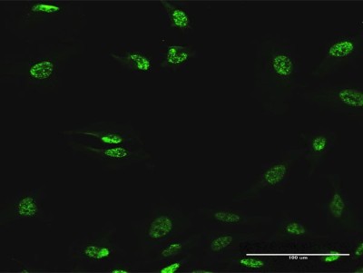 Immunocytochemistry/Immunofluorescence: ABHD11 Antibody [H00083451-B01P] - Analysis of purified antibody to ABHD11 on HeLa cell. (antibody concentration 30 ug/ml)