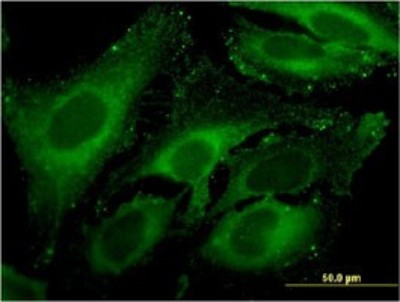 Immunocytochemistry/Immunofluorescence: Carboxypeptidase A4/CPA4 Antibody (1F4) [H00051200-M07] - Analysis of monoclonal antibody to CPA4 on HeLa cell. Antibody concentration 10 ug/ml