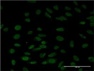 Immunocytochemistry/Immunofluorescence: LSM6 Antibody (4B5-1B10) [H00011157-M01] - Analysis of monoclonal antibody to LSM6 on HeLa cell. Antibody concentration 10 ug/ml.