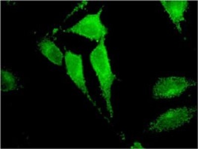 Immunocytochemistry/Immunofluorescence: TRIM17 Antibody (2E11) [H00051127-M01] - Analysis of monoclonal antibody to TRIM17 on HeLa cell. Antibody concentration 10 ug/ml.
