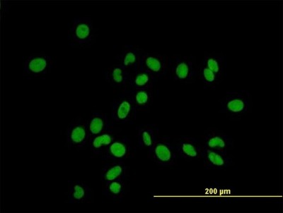 Immunocytochemistry/Immunofluorescence: ZFP37 Antibody [H00007539-B01P] - Analysis of purified antibody to ZFP37 on HeLa cell. (antibody concentration 10 ug/ml)