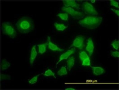 Immunocytochemistry/Immunofluorescence: PDIR Antibody (3A3) [H00010954-M01] - Analysis of monoclonal antibody to PDIA5 on HeLa cell. Antibody concentration 10 ug/ml.