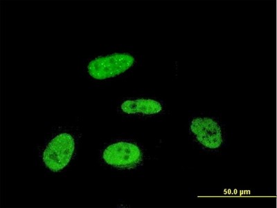 Immunocytochemistry/Immunofluorescence: PRKRIP1 Antibody (M1) [H00079706-M07] - Analysis of monoclonal antibody to PRKRIP1 on HeLa cell. Antibody concentration 10 ug/ml