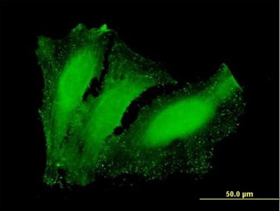 Immunocytochemistry/Immunofluorescence: NETO2 Antibody [H00081831-B01P] - Analysis of purified antibody to NETO2 on HeLa cell. (antibody concentration 10 ug/ml)
