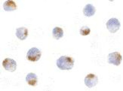 Immunocytochemistry/Immunofluorescence: Acinus Antibody [NBP1-76855] - K562 cells with Acinus antibody at 5 ug/ml.