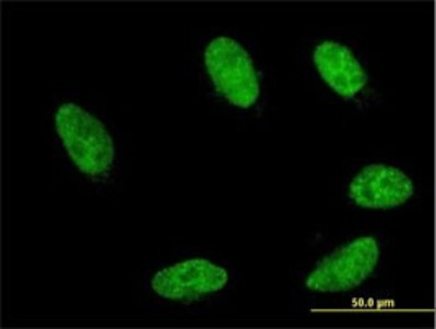 Immunocytochemistry/Immunofluorescence: GBX2 Antibody (2D8) [H00002637-M02] - Analysis of monoclonal antibody to GBX2 on HeLa cell. Antibody concentration 10 ug/ml.