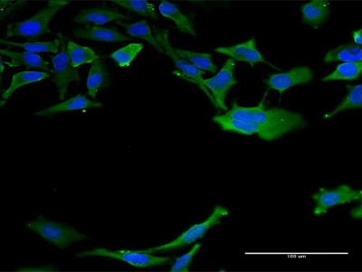 Immunocytochemistry/Immunofluorescence: Calmodulin 3 Antibody (1E2) [H00000808-M11] - Analysis of monoclonal antibody to CALM3 on HeLa cell. Antibody concentration 40 ug/ml