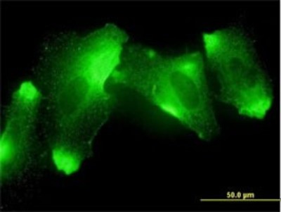 Immunocytochemistry/Immunofluorescence: MFRP Antibody (1E12) [H00083552-M01] - Analysis of monoclonal antibody to MFRP on HeLa cell. Antibody concentration 10 ug/ml.