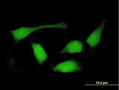 Immunocytochemistry/Immunofluorescence: Sorting Nexin 32 Antibody [H00254122-B01P] - Analysis of purified antibody to FLJ30934 on HeLa cell. (antibody concentration 10 ug/ml)