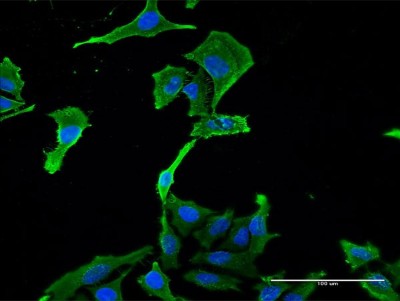 Immunocytochemistry/Immunofluorescence: BNC1 Antibody (1F4) [H00000646-M03] - Analysis of monoclonal antibody to BNC1 on HeLa cell. Antibody concentration 40 ug/ml